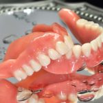 Phonetische Zahnaufstellung - Zahnkunstwerk