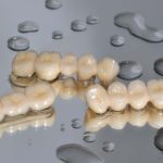 Zirkonkronen Zahnkunstwerk