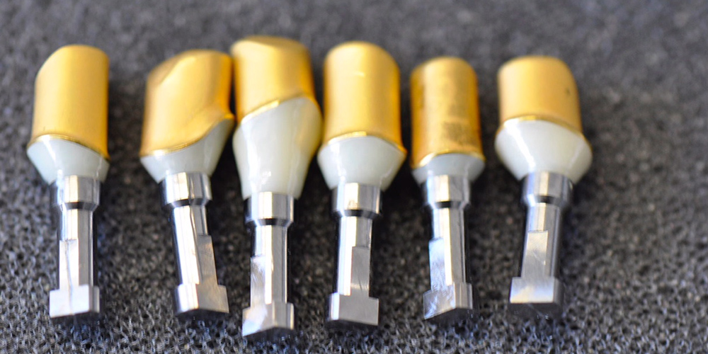 Gold in der Zahntechnik