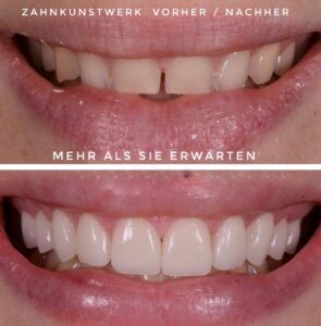 Die Kunst der Zahntechnik - Zahnkunstwerk