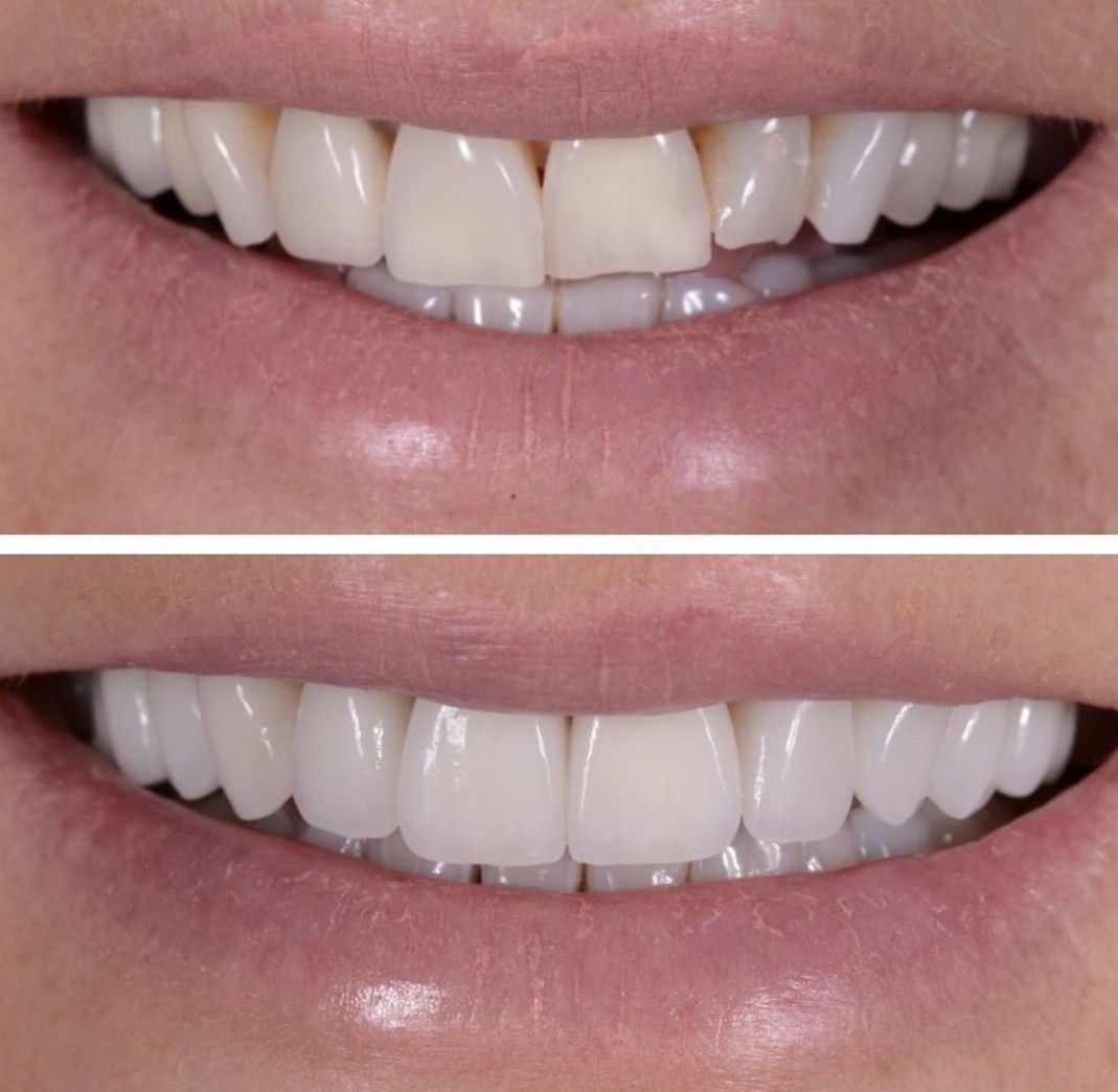 Zahnersatz | Zahnkunstwerk