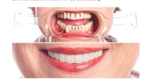 Kosmetische Ansicht vor der Behandlung im Dentallabor Witten