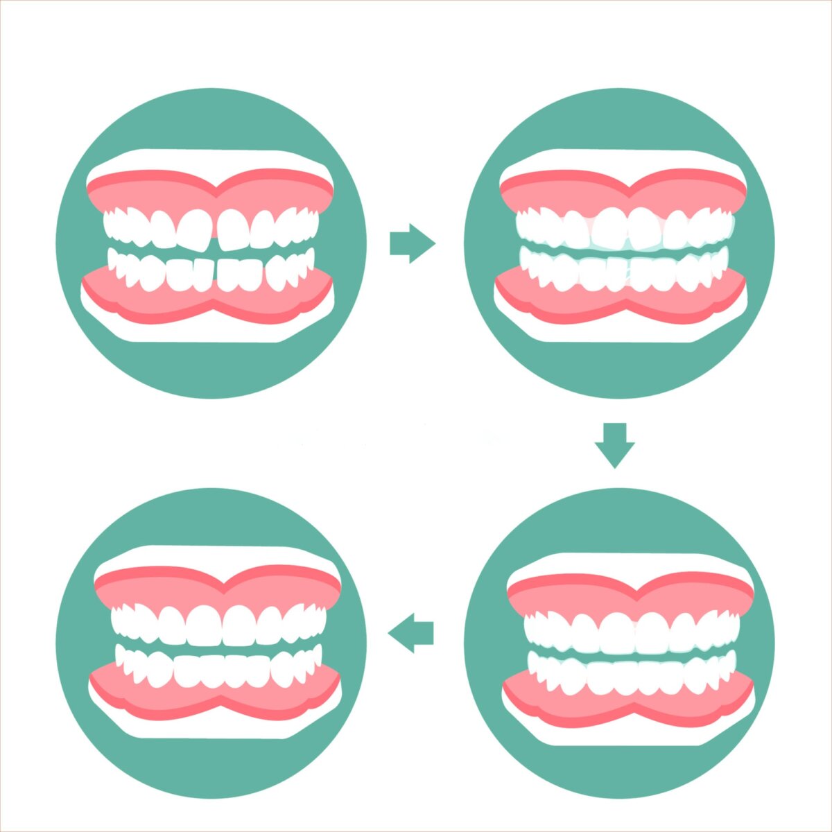 DER WUNSCH NACH GERADEN ZÄHNEN